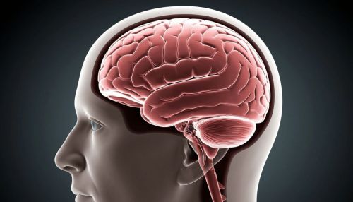 Ежегодно от инсульта умирает более миллиона людей