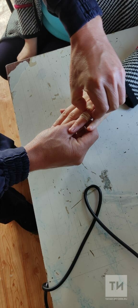 Жительнице Татарстана помогли снять застрявшее на пальце кольцо